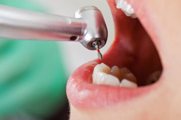 Best Knocked-Out Tooth Emergency  in Point Roberts, WA